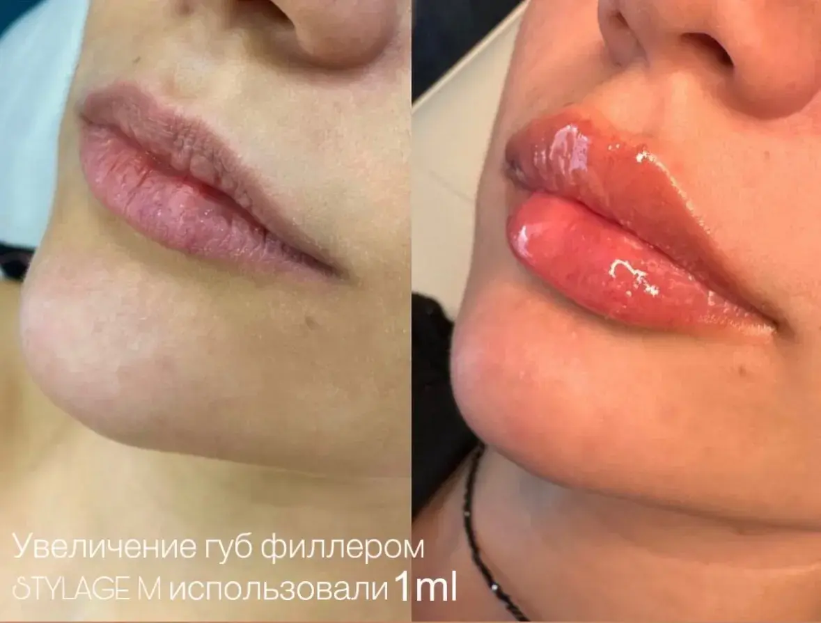губы губы